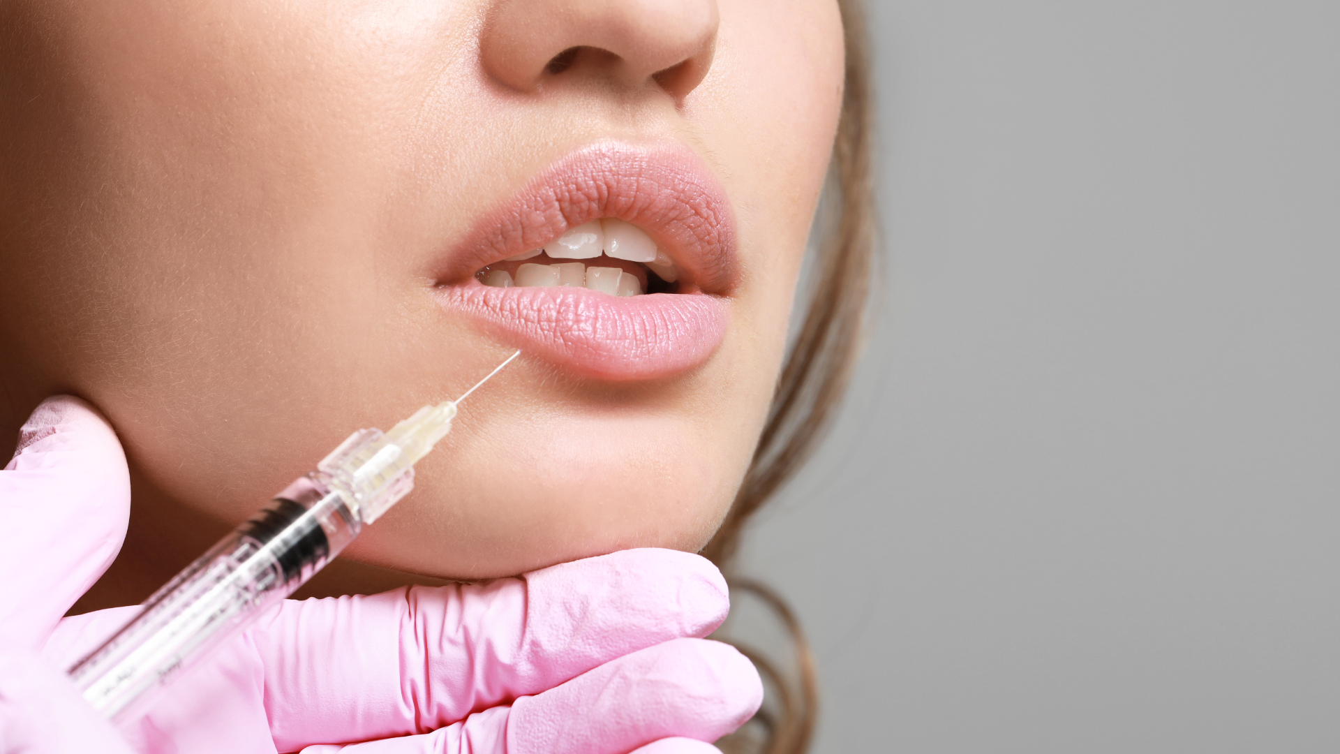 Enhancing Smiles, Exceeding Expectations: The Journey of Lip Filler Transformations at Soluma Aesthetics